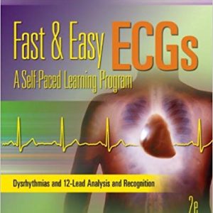 Fast And Easy Ecgs A Self Paced Learning Program 2e Bruce Shade Test Bank.jpg